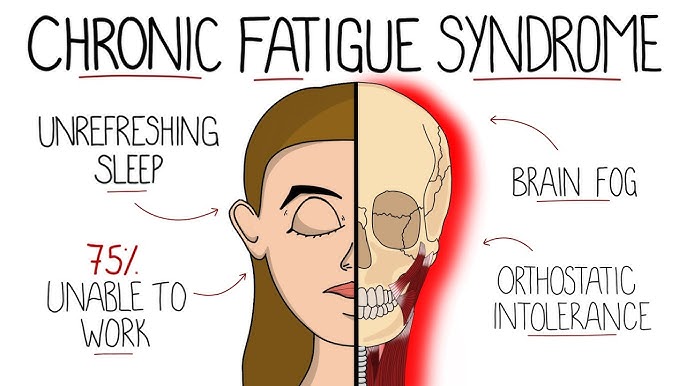 May is Myalgic Encephalomyelitis (ME) Awareness Month