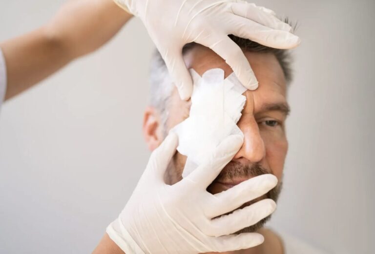 GUEST BLOG: Ian Powell – The wider implications of eyecare privatisation